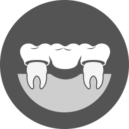 Implants & Tooth Replacement